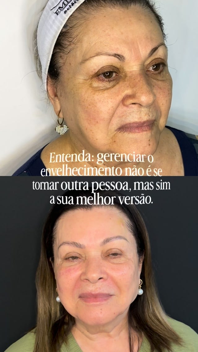Antes e depois